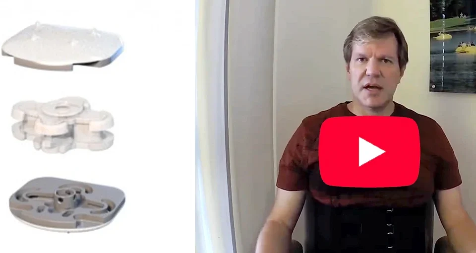 Back Pain, Sciatica, Artificial LP-ESP disc, Dr. Biren Desai, ADR