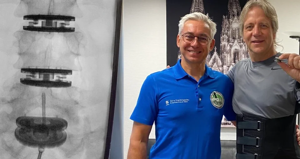 Nine weeks post-surgery, it is my pleasure to offer a review of my surgical experience ADR