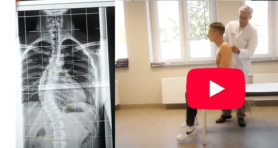 Golf OP Apifix Video