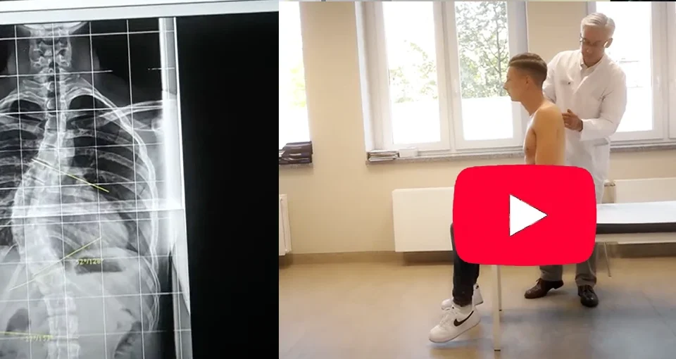 Golf OP Apifix Video