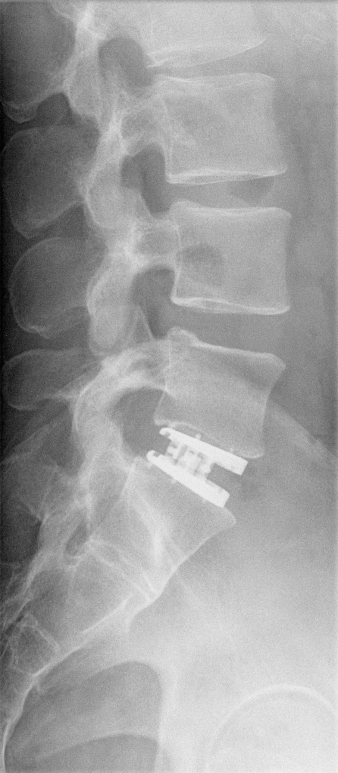 Dr. med. Biren Desai Wirbelsäulenchirurg und Spezialist für die Behandlung komplexer Erkrankungen der Wirbelsäule Köln NRW Deutschland