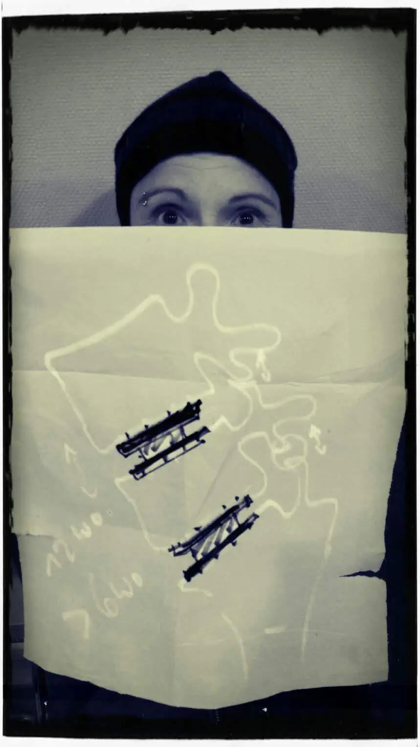 Dr. Biren Desai Köln – Mein Weg zum künstlichen Bandscheibenersatz