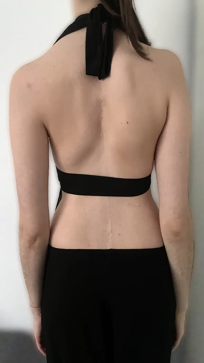 Dr. med. Biren Desai Wirbelsäulenchirurg und Spezialist für die Behandlung komplexer Erkrankungen der Wirbelsäule Köln NRW Deutschland